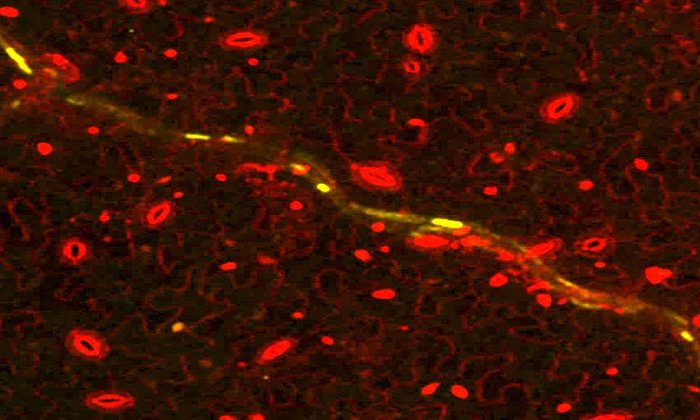 A microscope image can be seen. The background is black, a yellow fragmented and serpentine line runs from the bottom right to the top left. In addition, various small ovals can be seen in red on a background of red serpentine lines.
